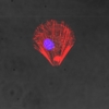 U2OS cell stained with SiR-actin