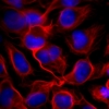 U2OS cells stained with SiR-tubulin