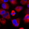 HeLa cells stained with SiR-tubulin
