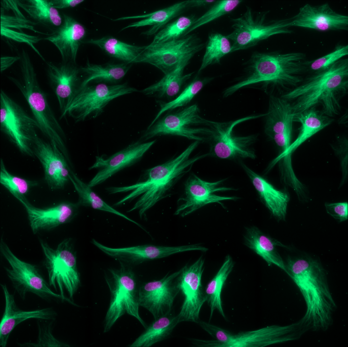 SiR-tubulin kit - Live cell microtubule probe - spirochrome