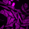 HeLa cells stained with 1x SPY555-actin