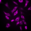 HeLa cells stained with 1x SPY555-tubulin