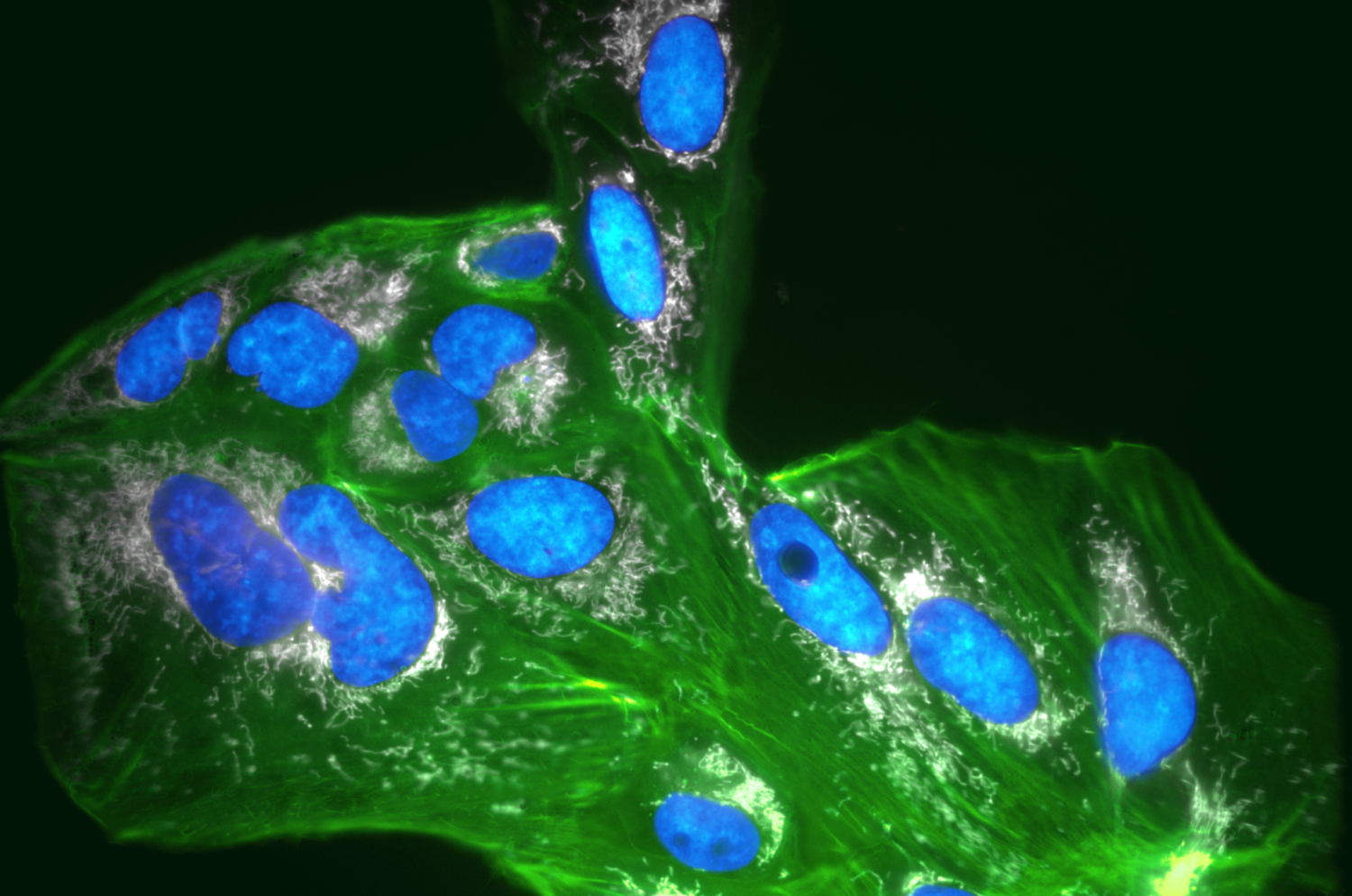 SPY488-FastAct™ - Green live cell actin probe - Spirochrome